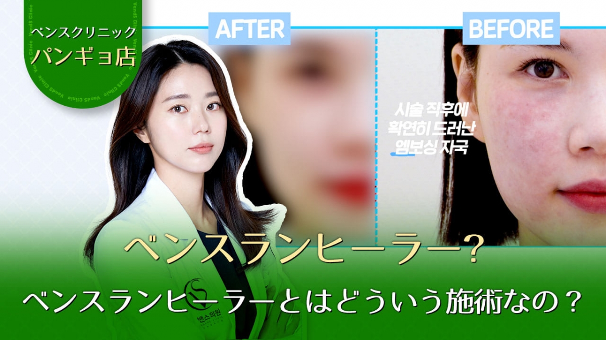 유튜브이미지