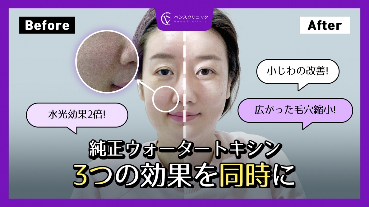 유튜브이미지