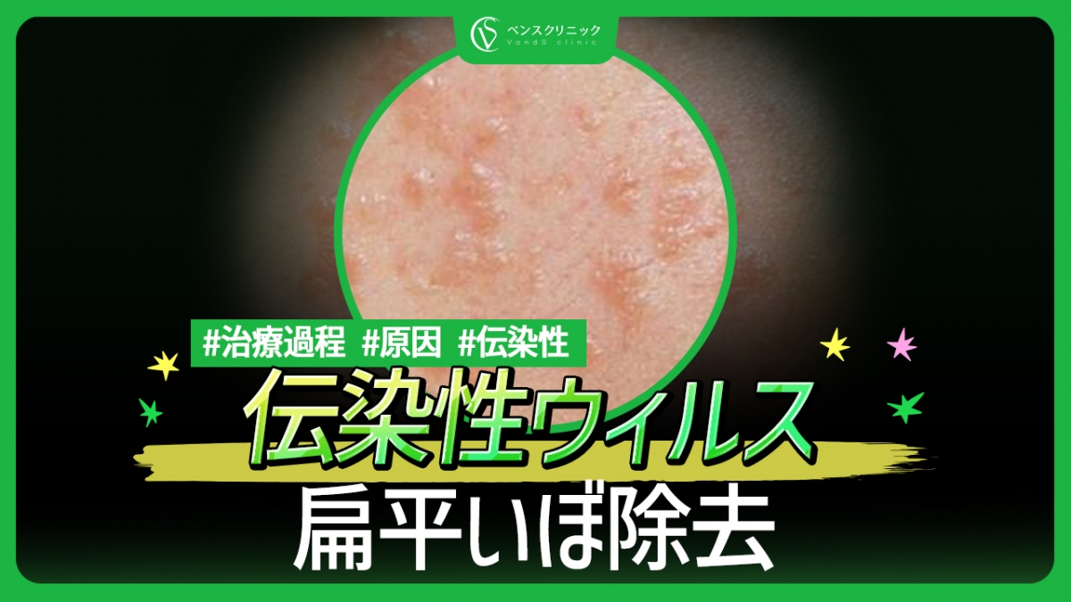 유튜브이미지